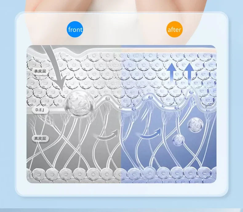 V-ansiktsløftestropp