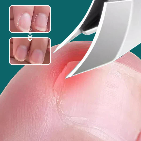 Sklisikre negleklippere med skråkant, sett med 3 deler